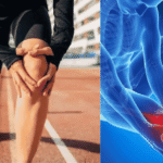 knee pain causes
