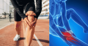 knee pain causes